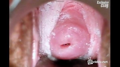 Esame ginecologicu di una bella donna